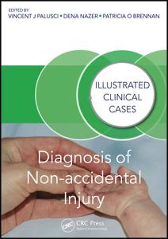 Diagnosis of Non-accidental Injury