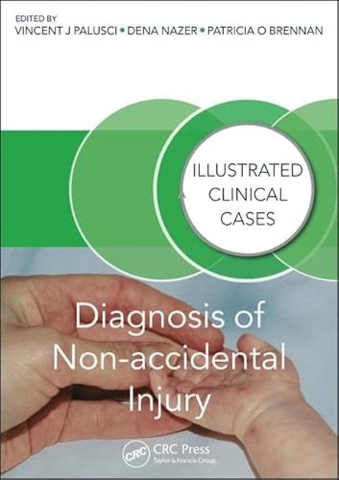 Diagnosis of Non-accidental Injury