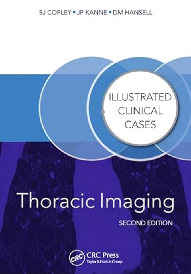 Thoracic Imaging