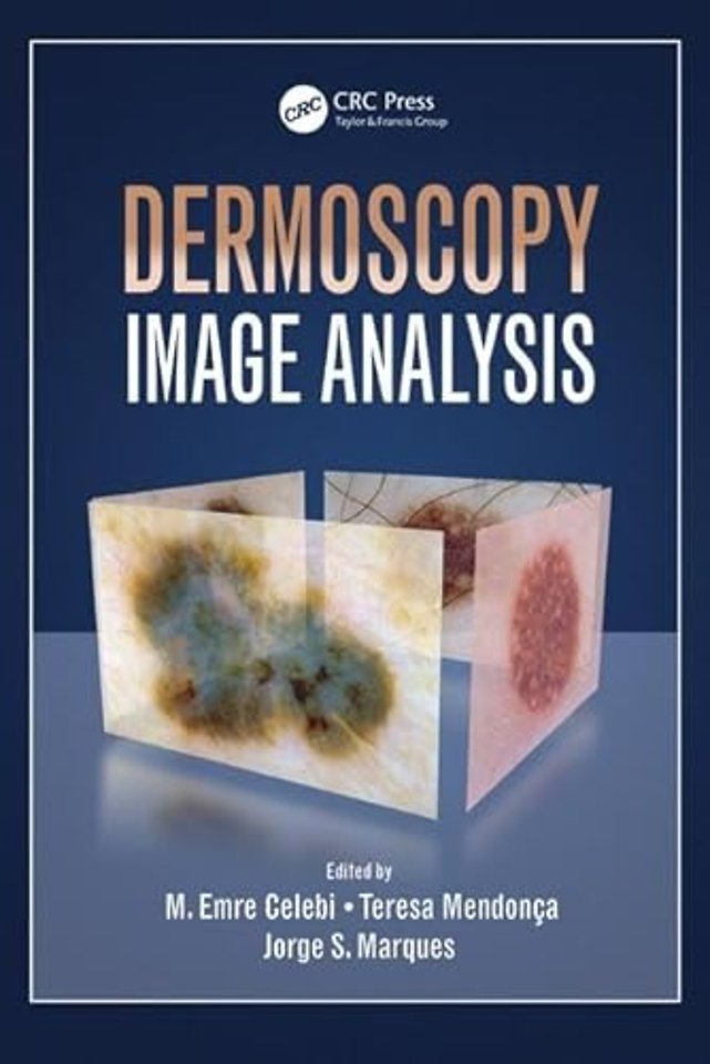 Dermoscopy Image Analysis