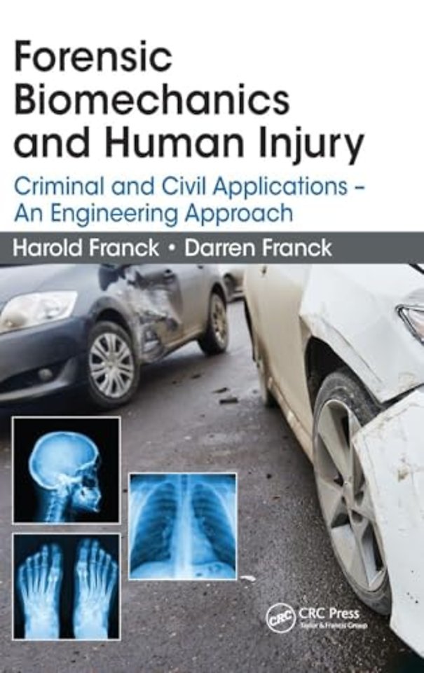 Forensic Biomechanics and Human Injury