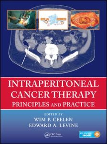 Intraperitoneal Cancer Therapy