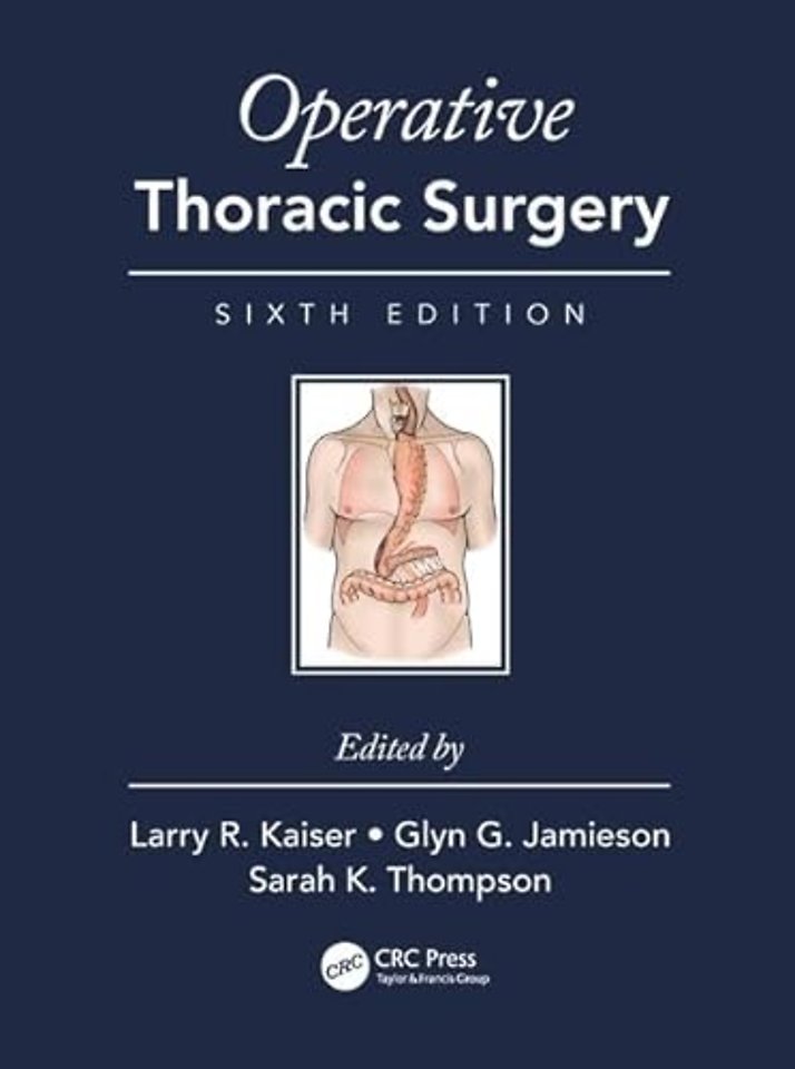 Operative Thoracic Surgery