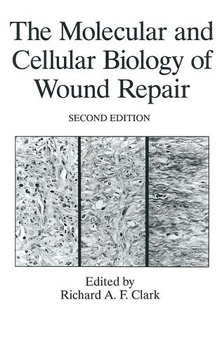 The Molecular and Cellular Biology of Wound Repair