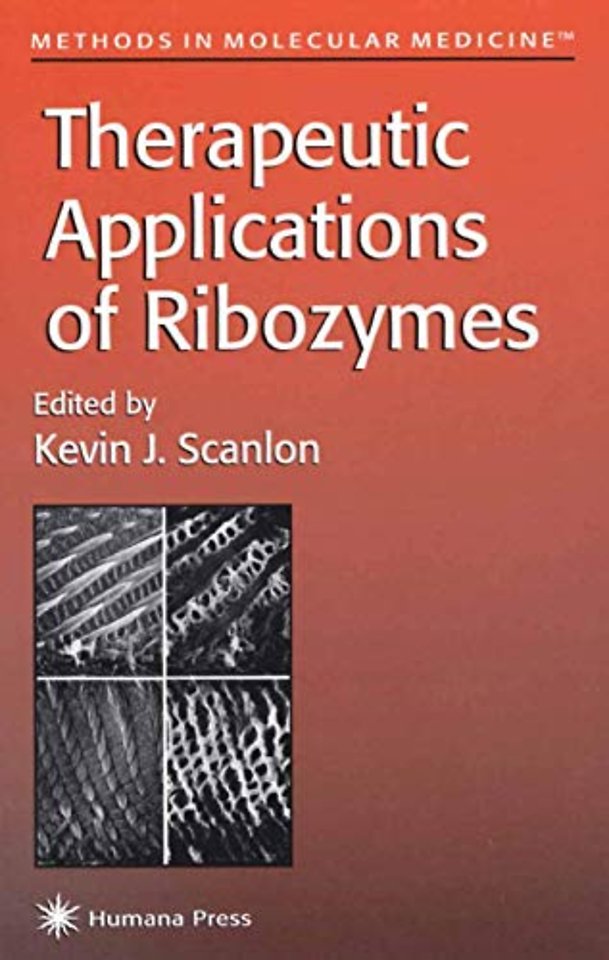 Therapeutic Applications of Ribozymes