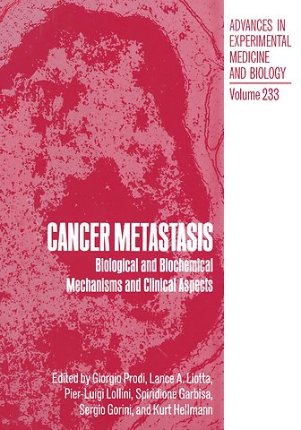 Cancer Metastasis