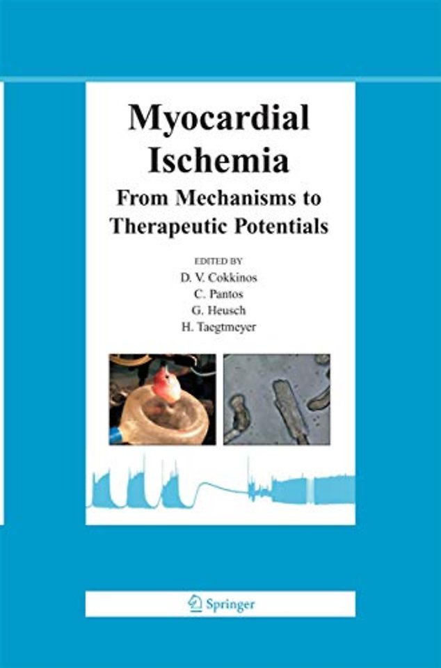 Myocardial Ischemia