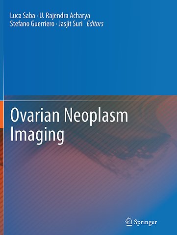 Ovarian Neoplasm Imaging