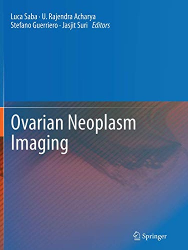 Ovarian Neoplasm Imaging