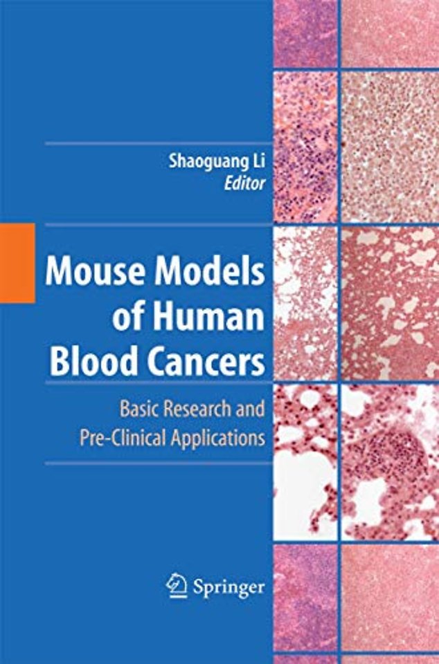 Mouse Models of Human Blood Cancers
