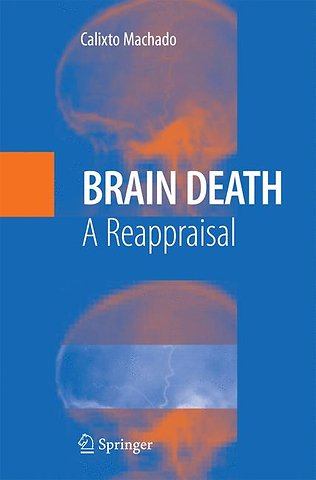 Brain Death