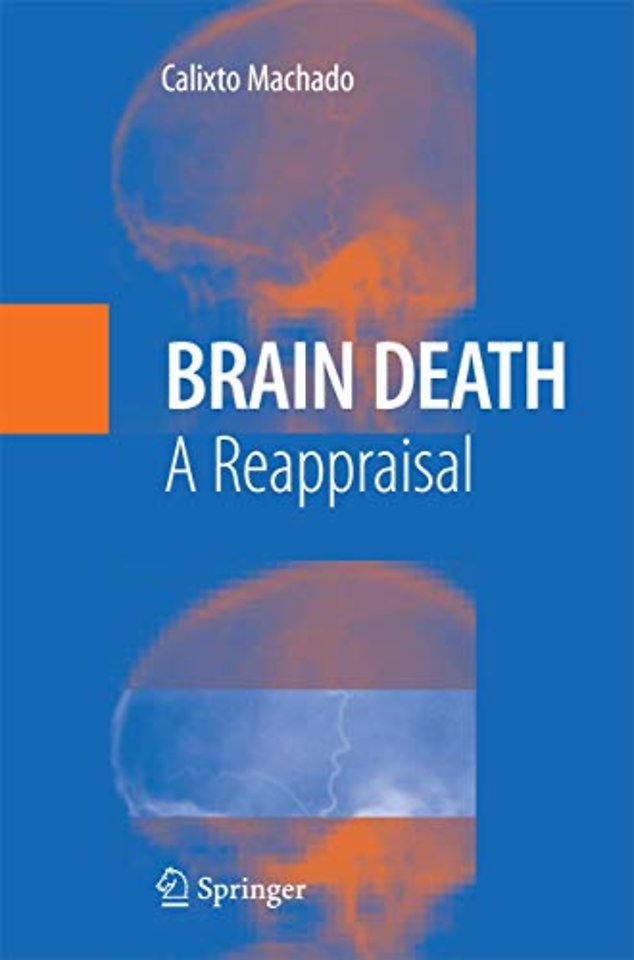Brain Death