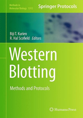 Western Blotting