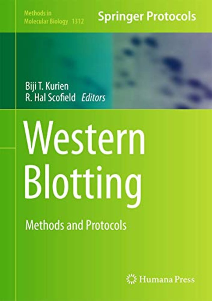 Western Blotting