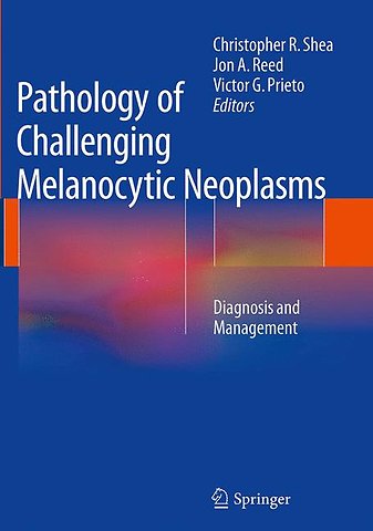 Pathology of Challenging Melanocytic Neoplasms