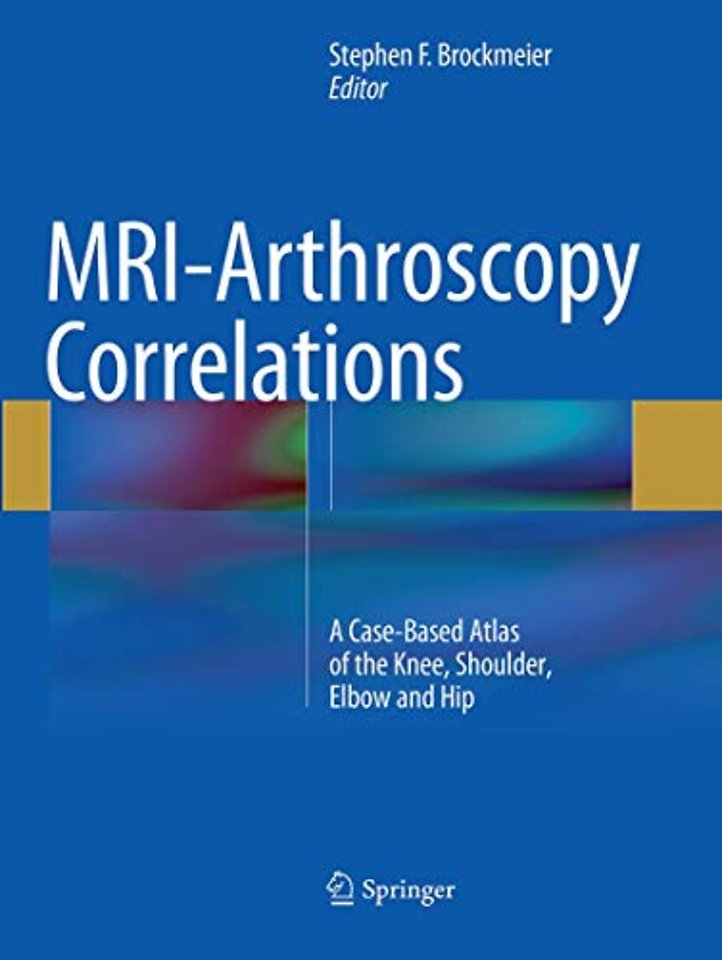 MRI-Arthroscopy Correlations