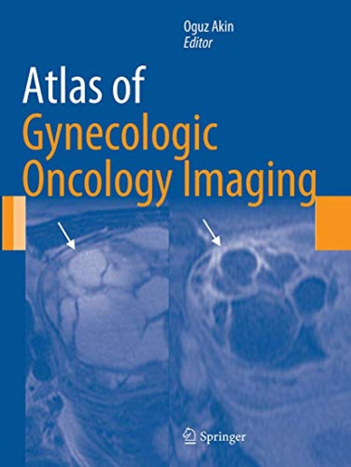 Atlas of Gynecologic Oncology Imaging