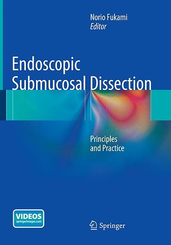 Endoscopic Submucosal Dissection