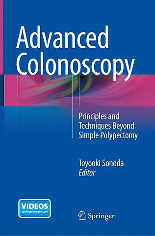 Advanced Colonoscopy