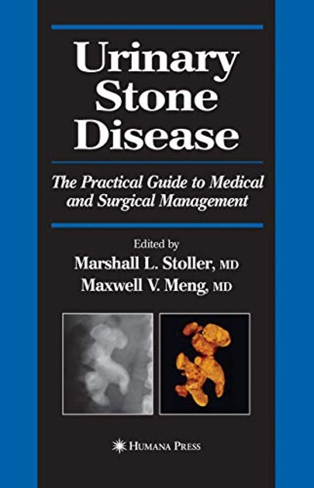 Urinary Stone Disease