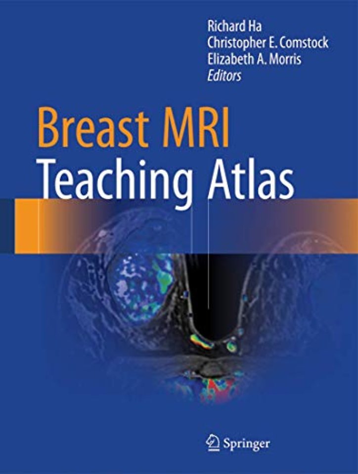 Breast MRI Teaching Atlas