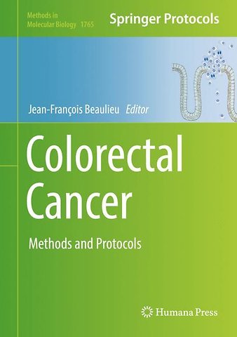 Colorectal Cancer