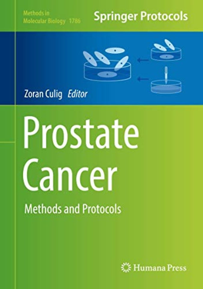 Prostate Cancer