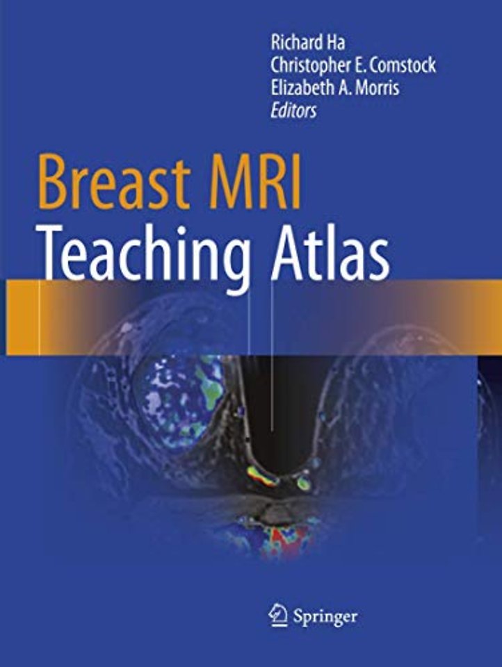 Breast MRI Teaching Atlas