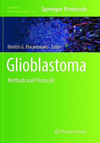 Glioblastoma