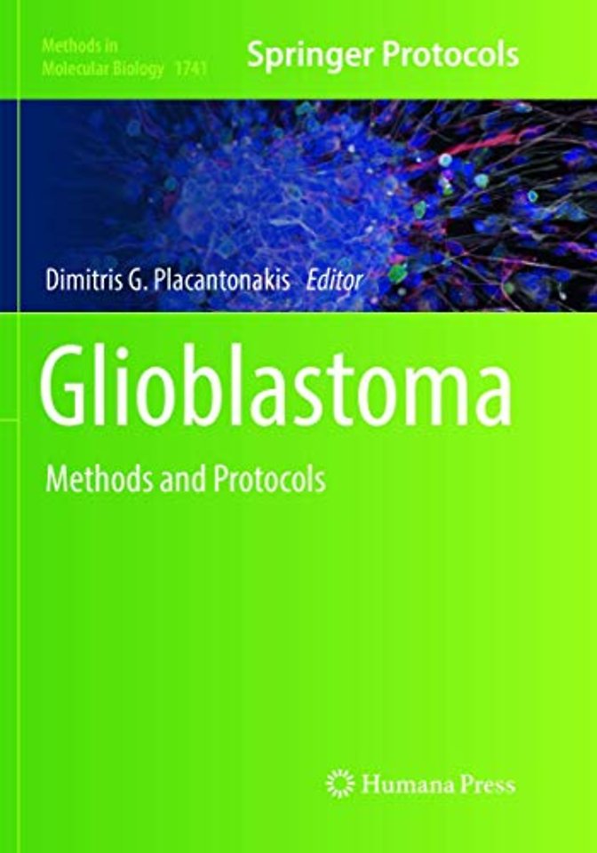 Glioblastoma