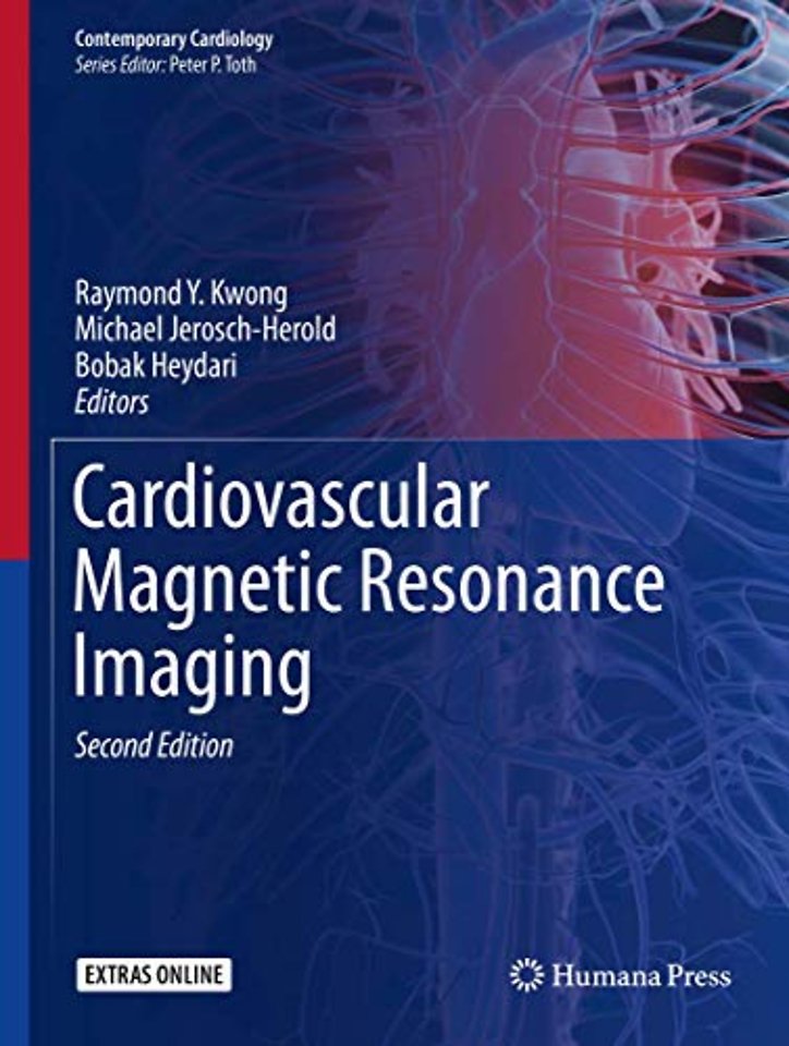 Cardiovascular Magnetic Resonance Imaging