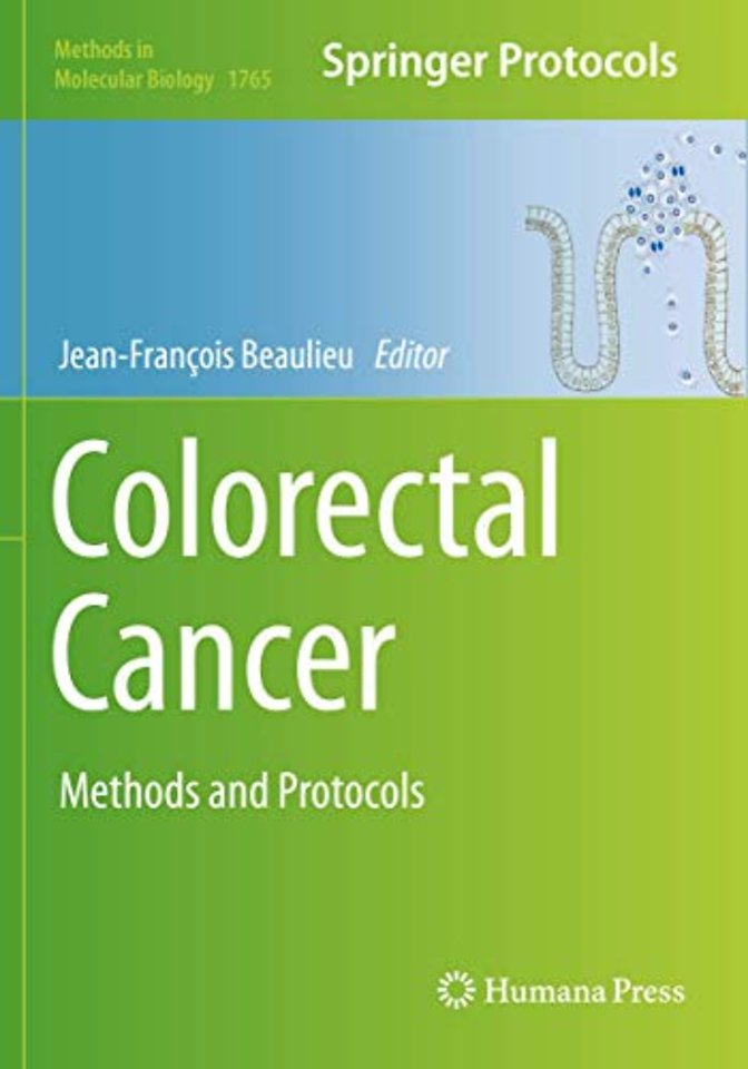 Colorectal Cancer