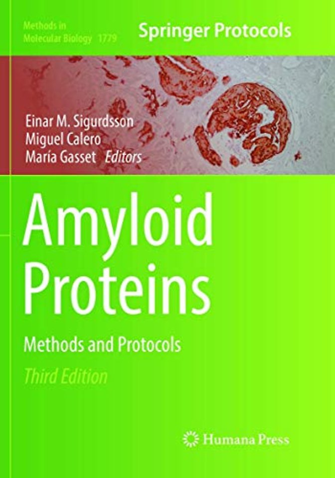 Amyloid Proteins