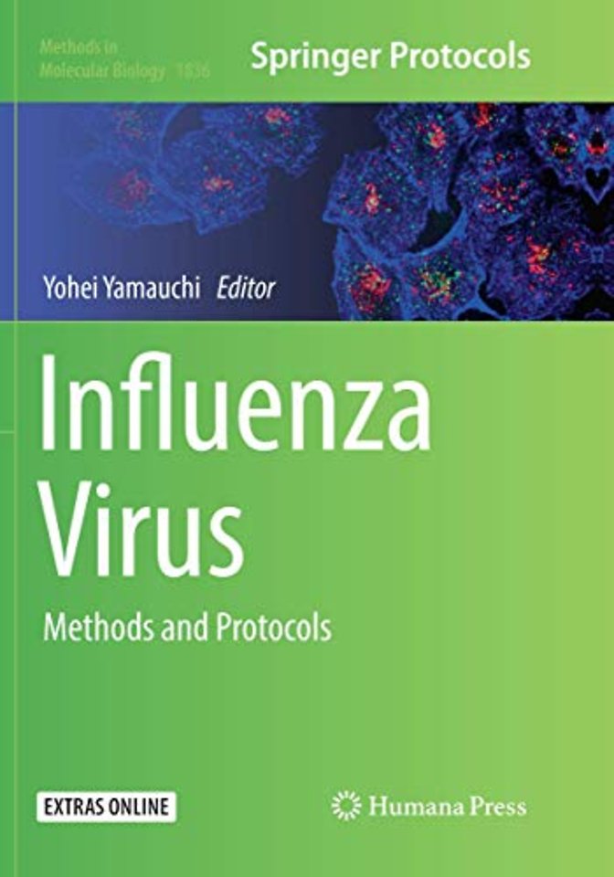 Influenza Virus