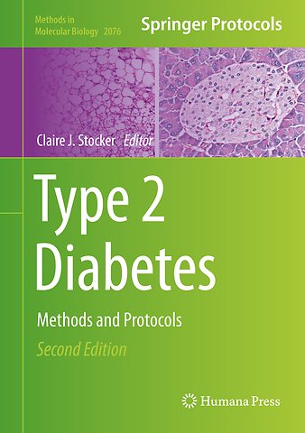 Type 2 Diabetes