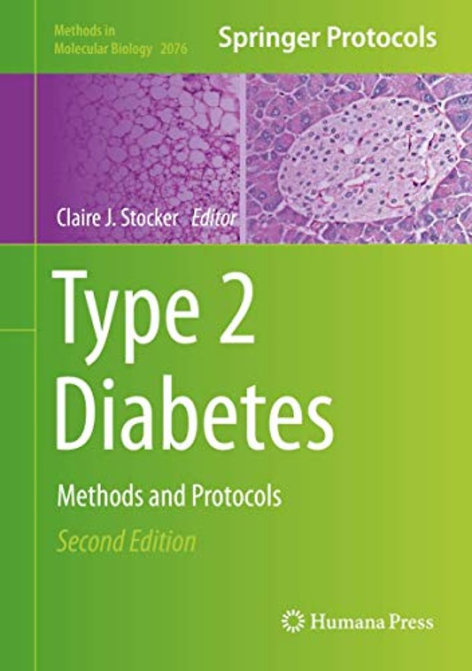 Type 2 Diabetes