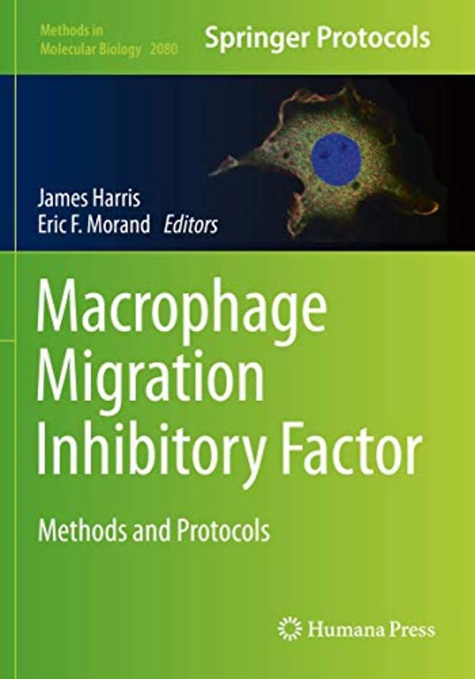 Macrophage Migration Inhibitory Factor