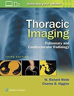 Thoracic Imaging: Pulmonary and Cardiovascular Rad