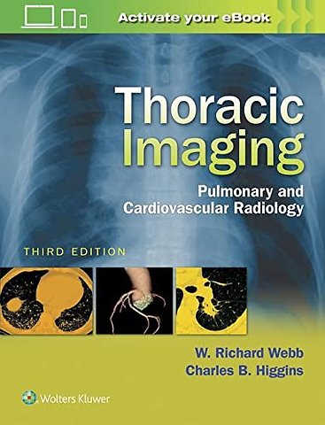 Thoracic Imaging: Pulmonary and Cardiovascular Rad