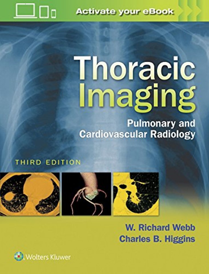 Thoracic Imaging: Pulmonary and Cardiovascular Rad