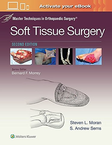 Master Techniques in Orthopaedic Surgery: Soft Tissue Surgery