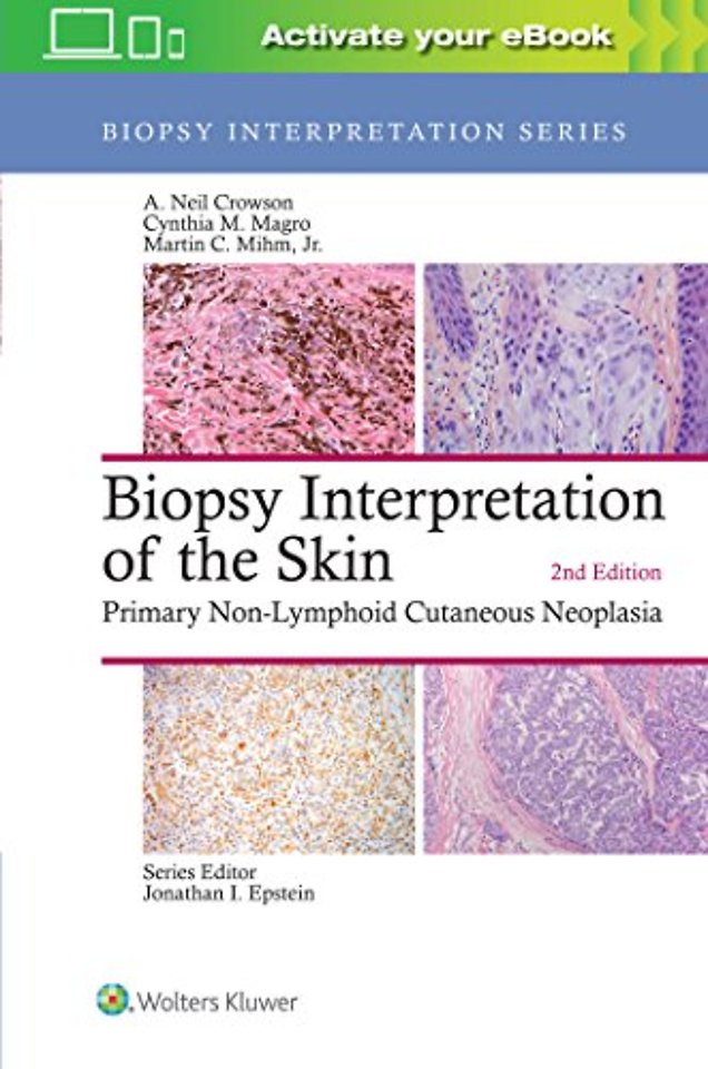 Biopsy Interpretation of the Skin