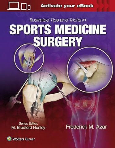 Illustrated Tips and Tricks in Sports Medicine Surgery