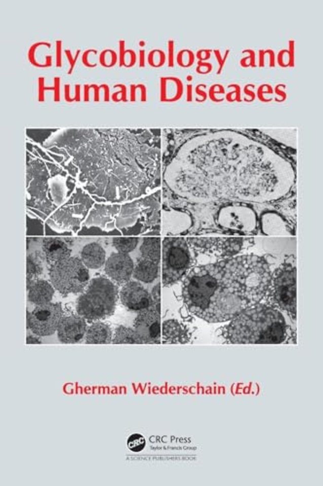 Glycobiology and Human Diseases