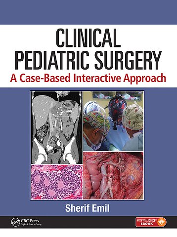Clinical Pediatric Surgery: A Case-Based Interactive Approach. Mirella & Lino Saputo Foundation edition
