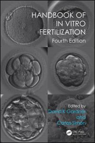 Handbook of In Vitro Fertilization