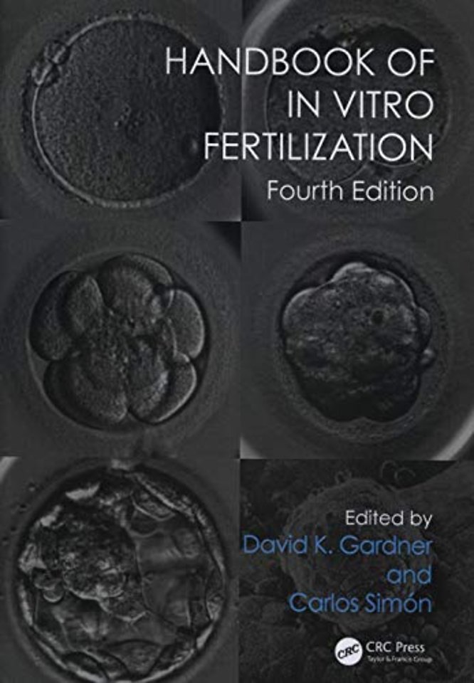 Handbook of In Vitro Fertilization