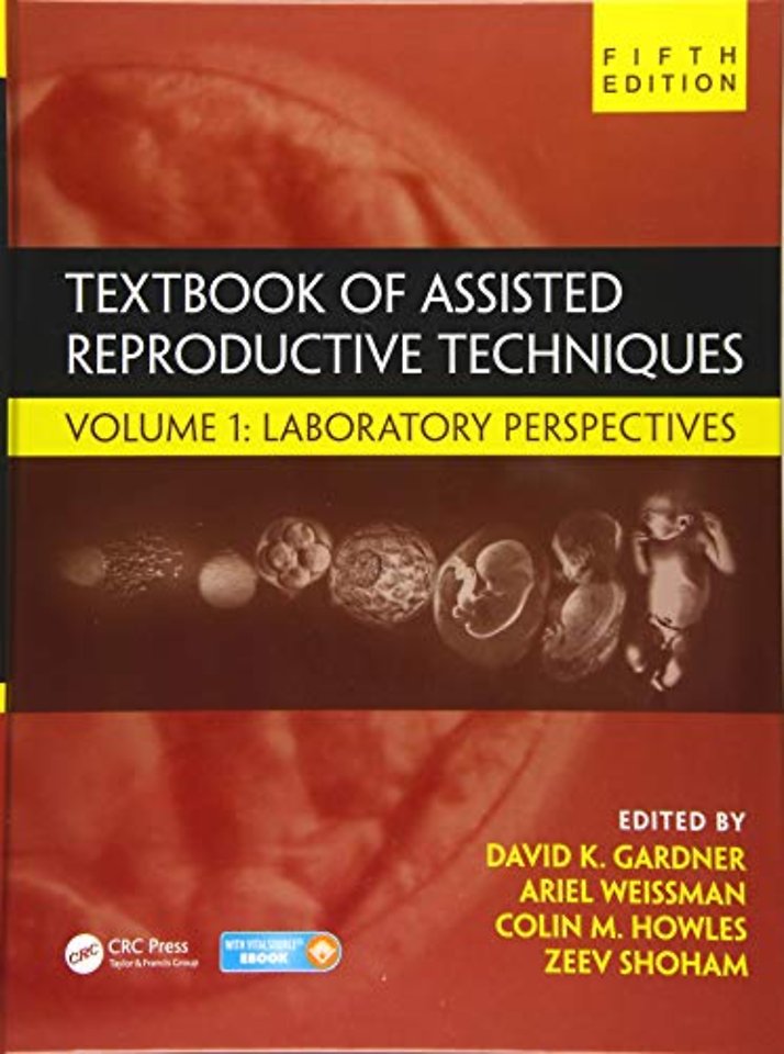 Textbook of Assisted Reproductive Techniques
