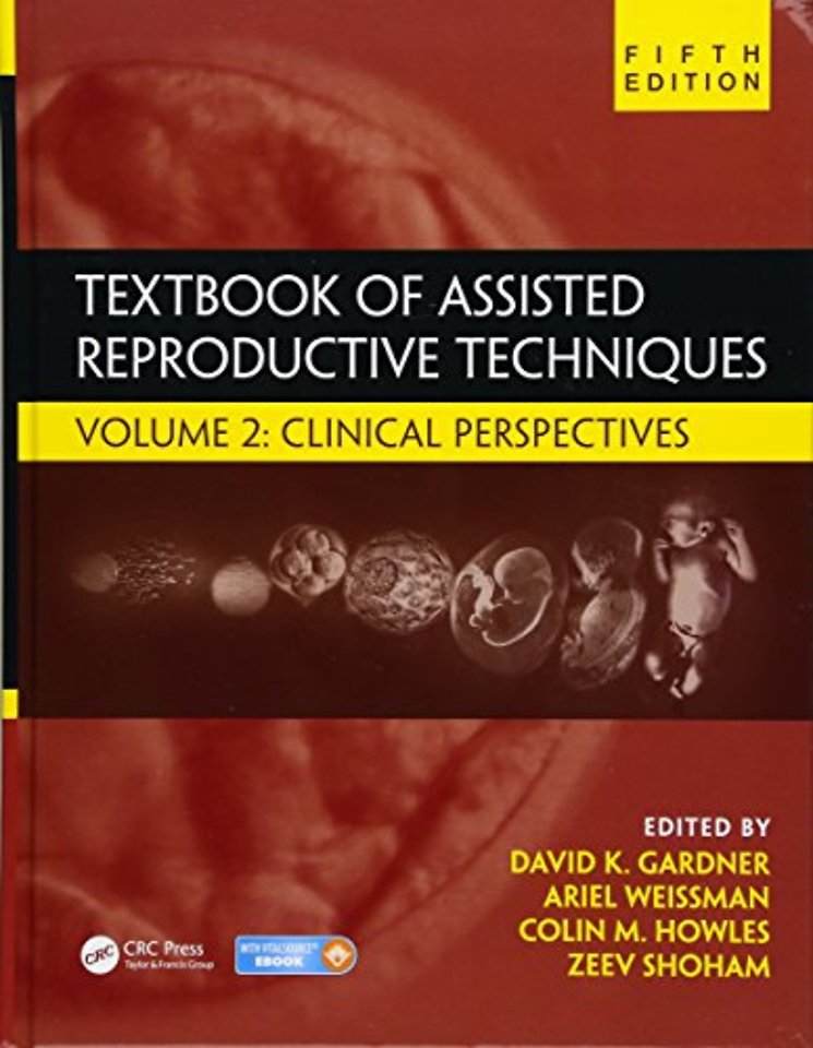 Textbook of Assisted Reproductive Techniques