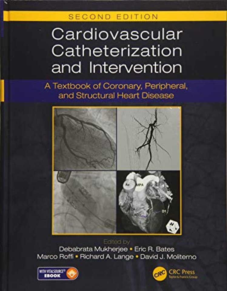 Cardiovascular Catheterization and Intervention